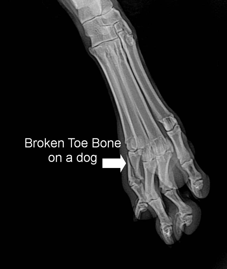 Toe Broken